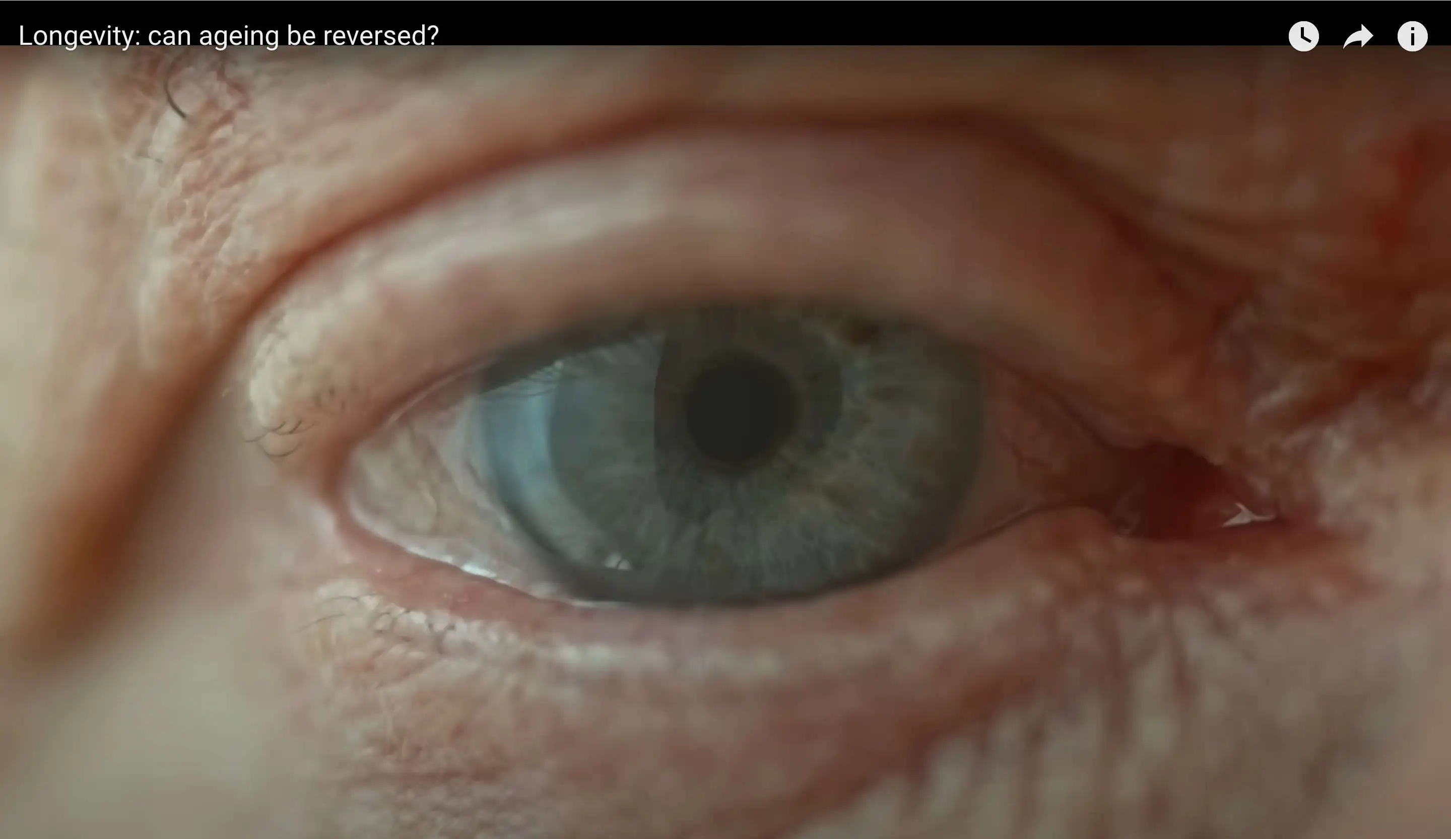Longevity: can ageing be reversed?